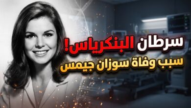 تفاصيل وسبب وفاة سوزان سانت جيمس بمرض السرطان